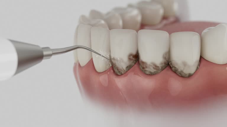 Reliable Emergency Dentist contractor in Devola, OH by Smile Center Dentistry